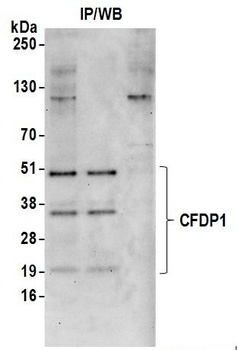 CFDP1 Antibody