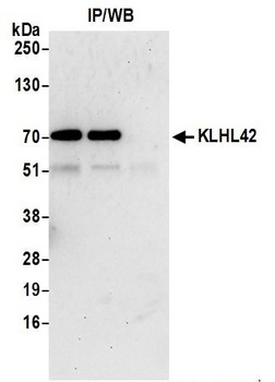 KLHL42 Antibody