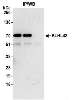 Rabbit anti-KLHL42 Antibody