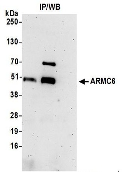 ARMC6 Antibody