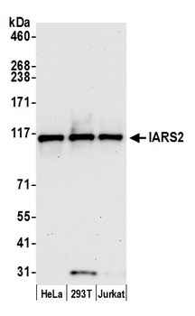 IARS2 Antibody