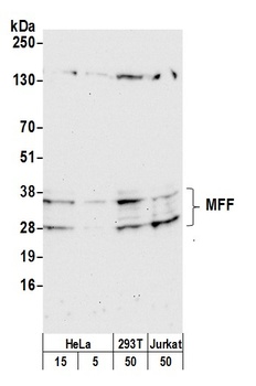Rabbit anti-MFF Antibody