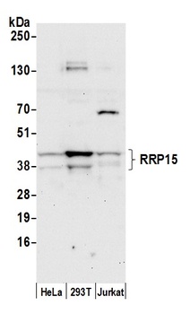 RRP15 Antibody