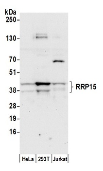 Rabbit anti-RRP15 Antibody