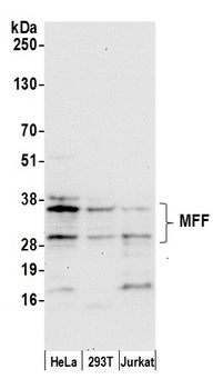 Rabbit anti-MFF Antibody