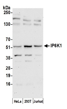 Rabbit anti-IP6K1 Antibody