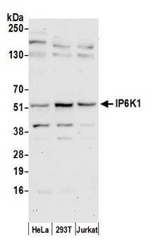 IP6K1 Antibody