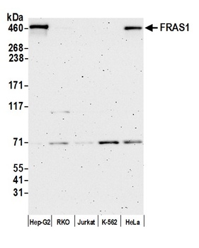 FRAS1 Antibody