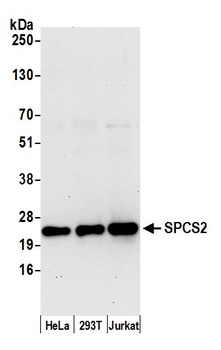 SPCS2 Antibody