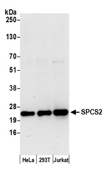 Rabbit anti-SPCS2 Antibody
