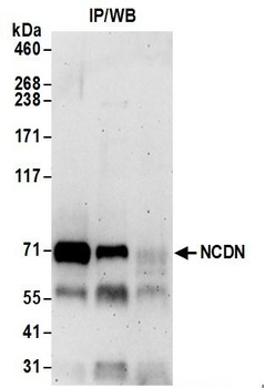 NCDN Antibody
