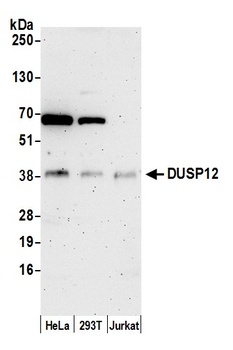 DUSP12 Antibody