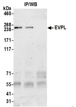 Rabbit anti-EVPL Antibody