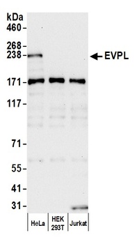 Rabbit anti-EVPL Antibody