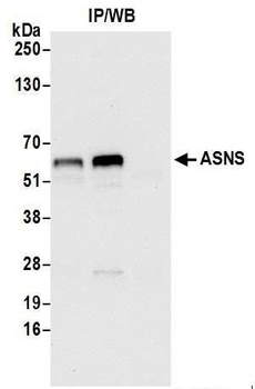 ASNS/Asparagine Synthetase Antibody