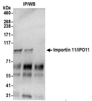Importin 11/IPO11 Antibody