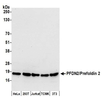 Rabbit anti-PFDN2/Prefoldin 2 Antibody