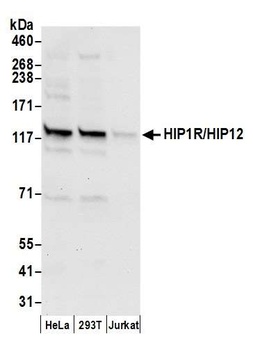 Rabbit anti-HIP1R/HIP12 Antibody