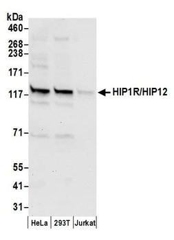 HIP1R/HIP12 Antibody