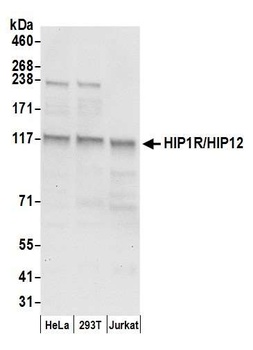 HIP1R/HIP12 Antibody