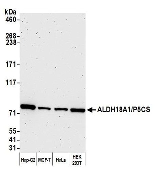 Rabbit anti-ALDH18A1/P5CS Antibody