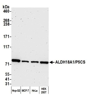 ALDH18A1/P5CS Antibody