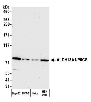 Rabbit anti-ALDH18A1/P5CS Antibody