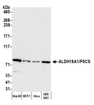 ALDH18A1/P5CS Antibody