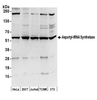 Aspartyl-tRNA Synthetase/DARS Antibody