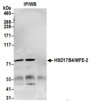 HSD17B4/MFE-2/17-beta-HSD4 Antibody