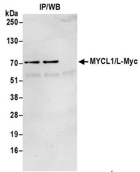 MYCL1/L-Myc Antibody