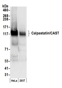 Calpastatin/CAST Antibody
