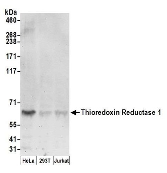 Thioredoxin Reductase 1/TXNRD1/TRXR1 Antibody