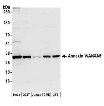Annexin V/ANXA5 Antibody