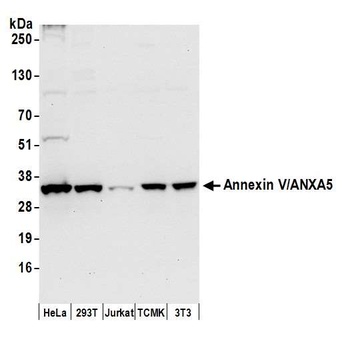 Rabbit anti-Annexin V/ANXA5 Antibody