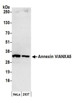 Annexin V/ANXA5 Antibody