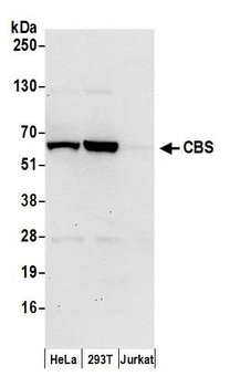 Rabbit anti-CBS Antibody
