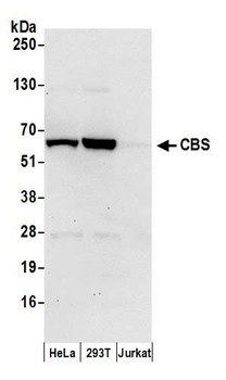 CBS Antibody