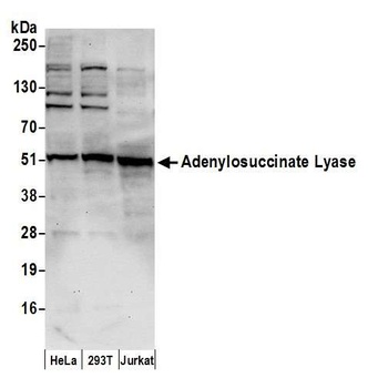 Adenylosuccinate Lyase/ADSL Antibody