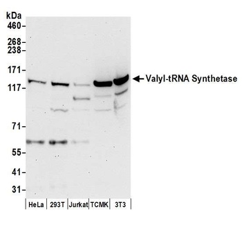 Rabbit anti-Valyl-tRNA Synthetase/VARS Antibody