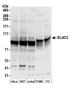 Rabbit anti-ELAC2 Antibody