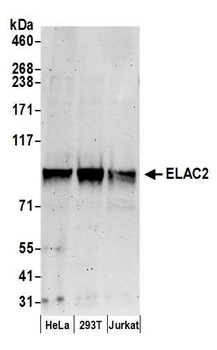 Rabbit anti-ELAC2 Antibody