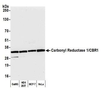 Carbonyl Reductase 1/CBR1 Antibody
