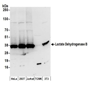 Rabbit anti-Lactate Dehydrogenase B/LDHB Antibody