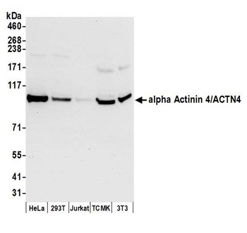 alpha Actinin 4/ACTN4 Antibody