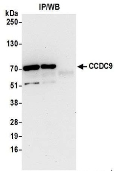 CCDC9 Antibody