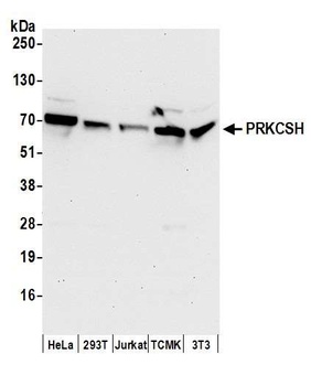 PRKCSH Antibody