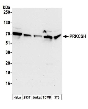 Rabbit anti-PRKCSH Antibody