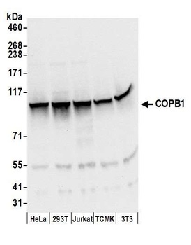 Rabbit anti-COPB1 Antibody