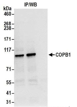 COPB1 Antibody
